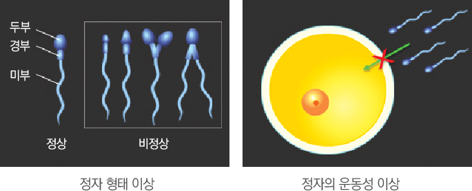 Á¤ÀÚÀÇ ÇüÅÂÀÌ»ó°ú ¿îµ¿¼ºÀÌ»ó