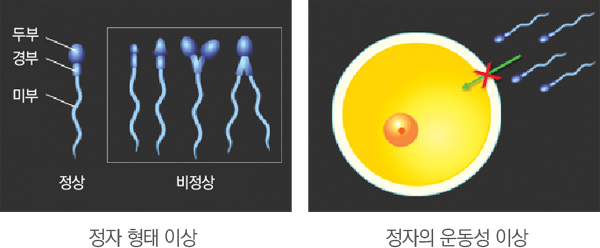 Á¤ÀÚÀÇ ÇüÅÂÀÌ»ó°ú ¿îµ¿¼ºÀÌ»ó