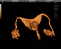 Àڱó°üÁ¶¿µ ÃÊÀ½ÆÄ