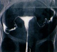 ³ªÆÈ°ü X¼± Á¶¿µ¼ú