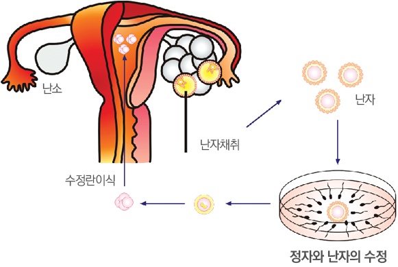 ü¿Ü¼öÁ¤½Ã¼ú ¼ø¼