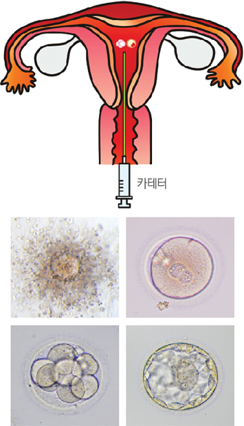 Àڱó» ¹è¾ÆÀ̽İú Á¤ÀÚ¿Í ³ÀÚÀÇ ¼öÁ¤ ¹× ¹ß´Þ