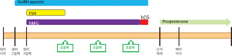 GnRH agonist ´Ü±â¿ä¹ý