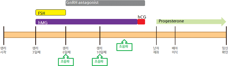 GnRH antagonist ±æÇ׿ä¹ý