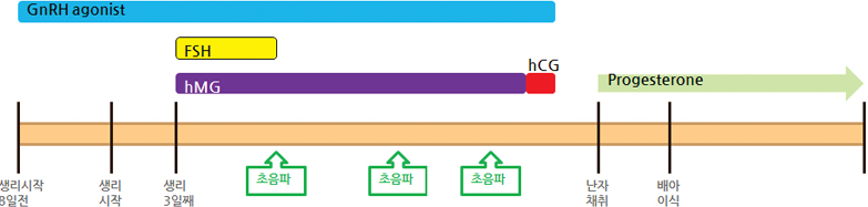 GnRH agonist 